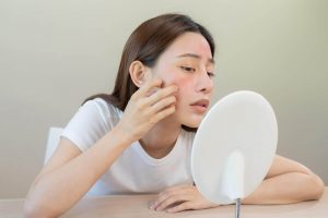Woman with skincare rash looking in the mirror