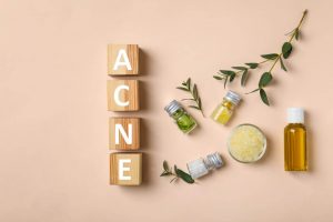 acne and treatments